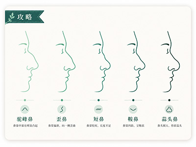 鼻畸形矫正全解